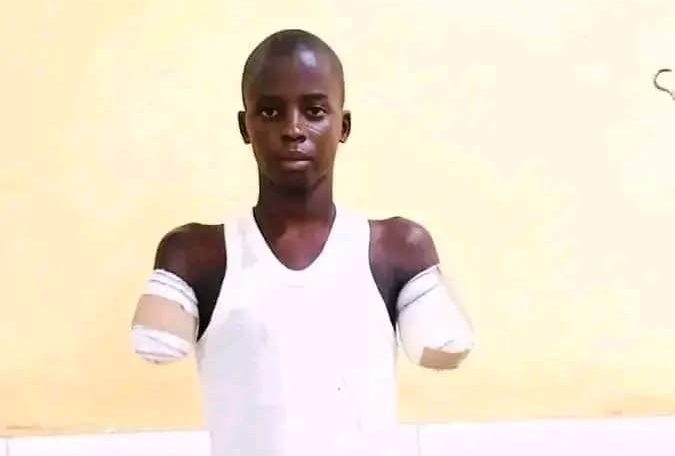 Children’s Day: Gombe NBA Condemns 12-year-old’s amputation over phone theft