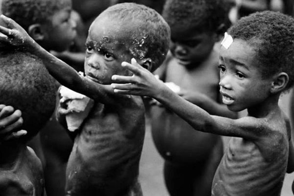 There is severe malnourished children in seven northern states