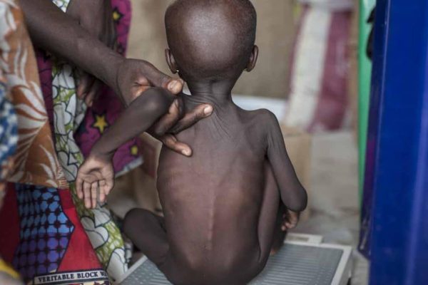 Nigerian govt confirms over 4m children malnourished in Northeast