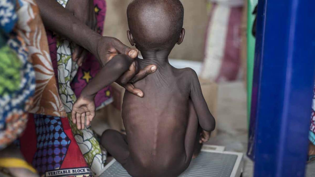 Nigerian govt confirms over 4m children malnourished in Northeast